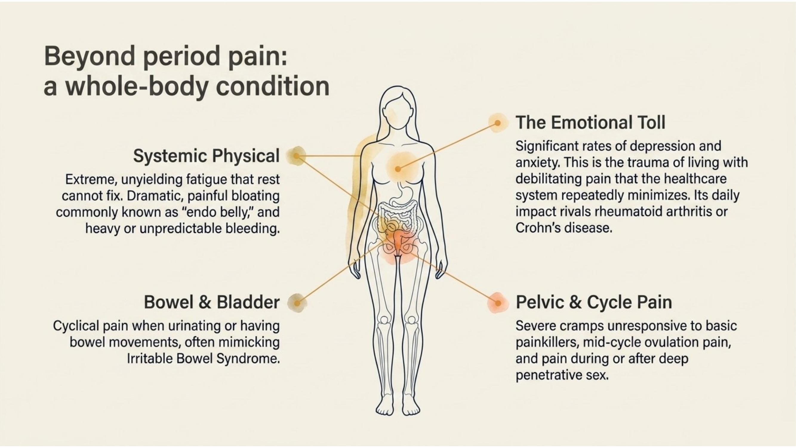 Illustration of the different types of pain caused by endometriosis