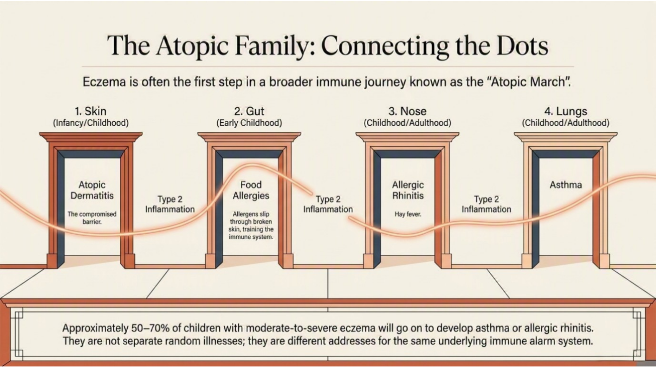 The atopic march — from eczema in infancy to allergies and asthma