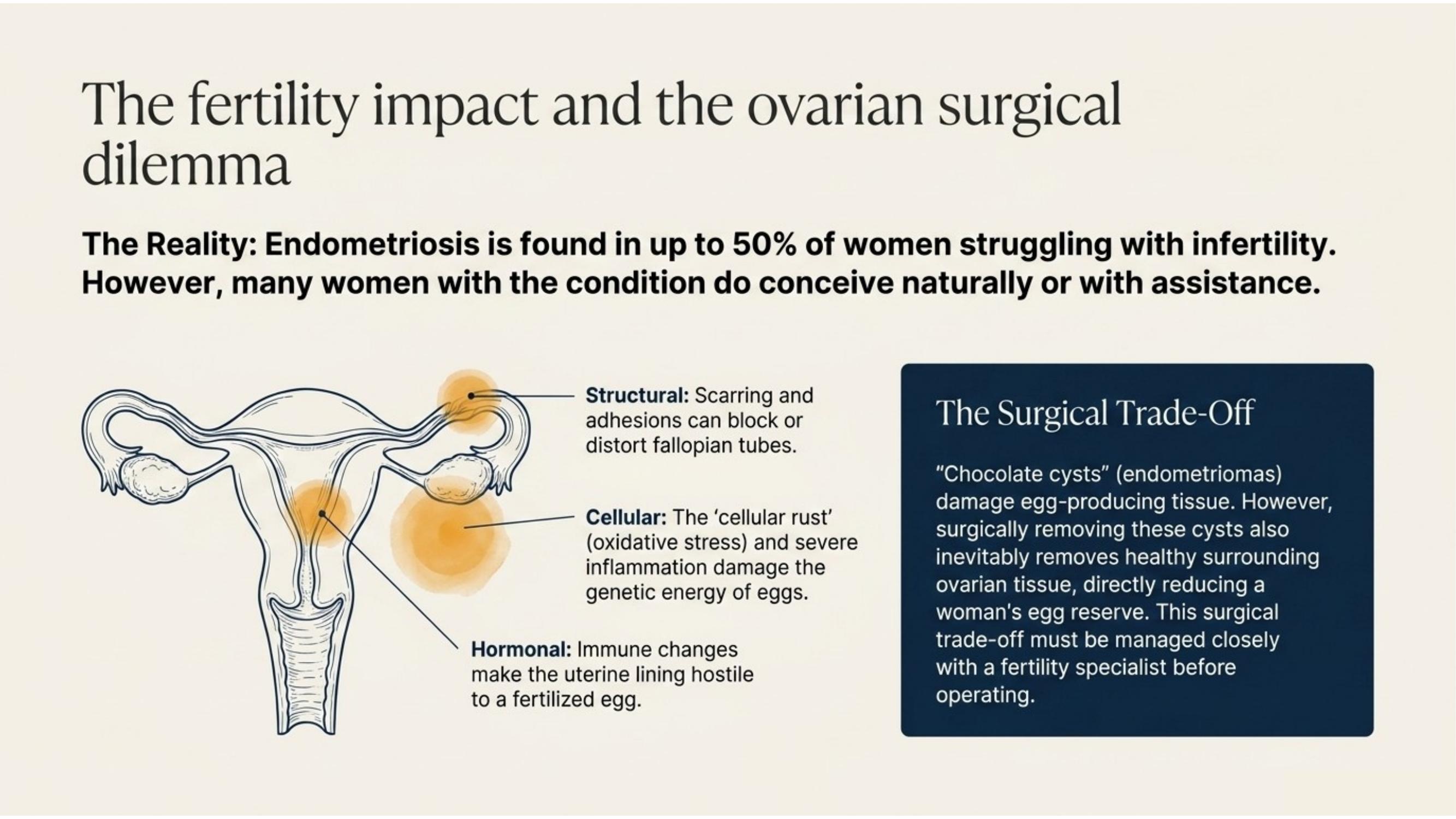 Diagram illustrating how endometriosis affects fertility